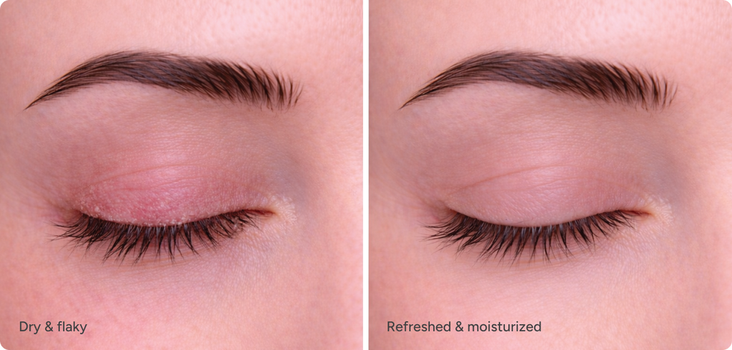 Ndemex™ Revitalizing Eye Serum with Tea Tree Oil